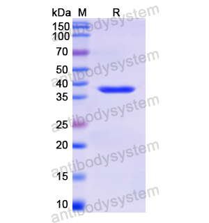 重组KRT6A蛋白,Recombinant Human KRT6A, N-His