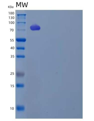 Recombinant Human Low-Density Lipoprotein Receptor/LDLR Protein(C-6His/AVI),Recombinant Human Low-Density Lipoprotein Receptor/LDLR Protein(C-6His/AVI)