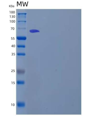 Recombinant Human Cadherin-8/CDH8 Protein(C-6His),Recombinant Human Cadherin-8/CDH8 Protein(C-6His)