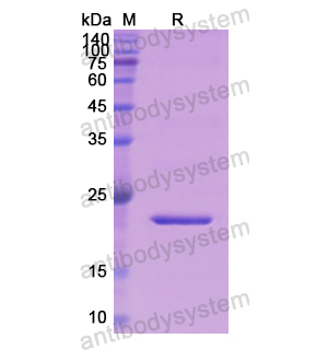 重組APOC3蛋白,Recombinant Human APOC3, N-SUMO