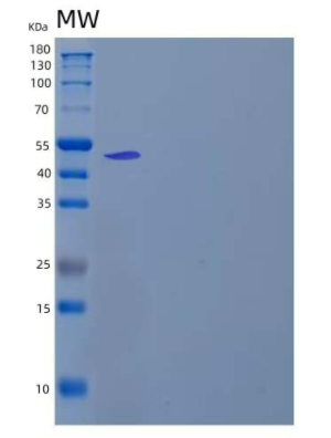 Recombinant Human Lysosomal Pro-X Carboxypeptidase/PRCP Protein(C-6His),Recombinant Human Lysosomal Pro-X Carboxypeptidase/PRCP Protein(C-6His)