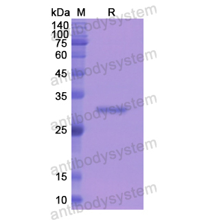 重組CD233/SLC4A1蛋白,Recombinant Human CD233/SLC4A1, N-His