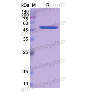 重組APCS蛋白,Recombinant Human APCS, N-GST