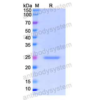 重組C1QB蛋白,Recombinant Human C1QB, N-His