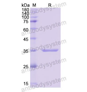 重組LRG1蛋白,Recombinant Human LRG1, N-His