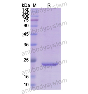 重组RBP4蛋白,Recombinant Human RBP4, N-His