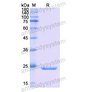 重組AMBP蛋白,Recombinant Human AMBP, N-His