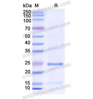 重组ORM1/a1AGP蛋白,Recombinant Human ORM1/a1AGP, N-His