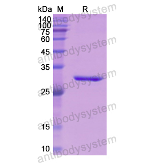 重組AHSG蛋白,Recombinant Human AHSG, N-His