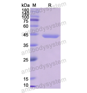 重組DBP/GC蛋白,Recombinant Human DBP/GC, N-His