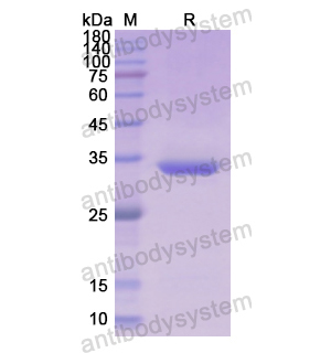 重组PF4/CXCL4蛋白,Recombinant Human PF4/CXCL4, N-GST