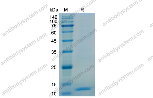 重组CXCL10/IP-10蛋白,Recombinant Human CXCL10/IP-10, N-His