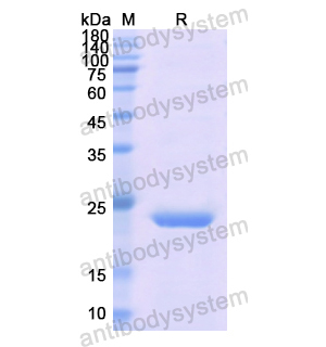 重組FTL蛋白,Recombinant Human FTL, N-His