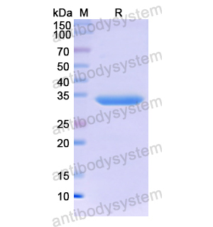 重組MT2A蛋白,Recombinant Human MT2A, N-GST