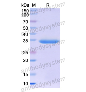 重組MT-ND1蛋白,Recombinant Human MT-ND1, N-GST