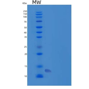Recombinant Human Osteocrin Protein(N-6His),Recombinant Human Osteocrin Protein(N-6His)