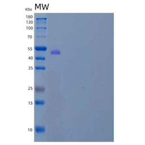 Recombinant Human Probable Serine Carboxypeptidase CPVL/VCP-Like Protein Protein(C-6His)