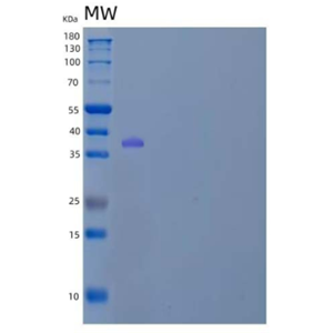 Recombinant Human Annexin A3/ANXA3 Protein