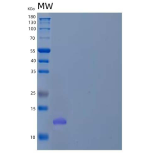 Recombinant Human WW Domain-Binding Protein 2/WBP2 Protein(N-6His)