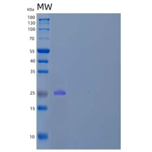 Recombinant Human V-Set and Transmembrane Domain-Containing 2A/VSTM2A Protein(C-6His)