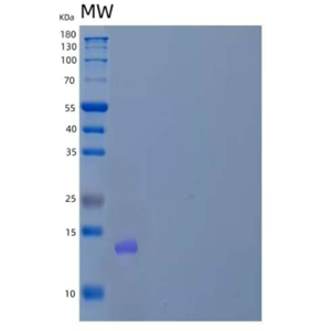 Recombinant Human Proprotein Convertase Subtilisin/Kexin Type 9/PCSK9 Protein(C-6His/HA/AVI)