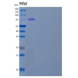 Recombinant Human Xaa-Pro Aminopeptidase 1/XPNPEP1 Protein(C-6His),Recombinant Human Xaa-Pro Aminopeptidase 1/XPNPEP1 Protein(C-6His)