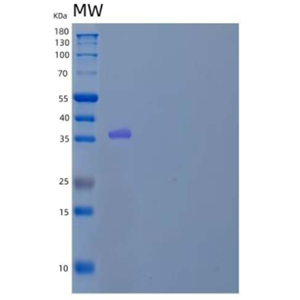 Recombinant Human Cytosolic Sulfotransferase Family 1A Member 3 Protein