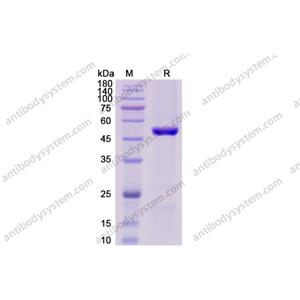 Recombinant Human CD4, C-His