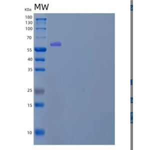 Recombinant Human Karyopherin Subunit α-2 /KPNA2/IPOA1 Protein(N-6His)