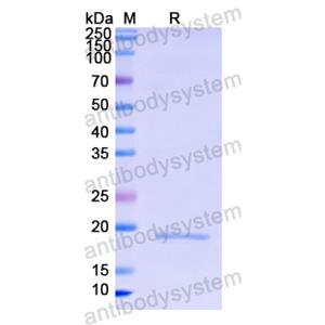 Recombinant Human CD8A, N-His