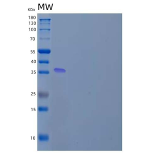 Recombinant Human Arginase-1/ARG1 Protein(C-6His)