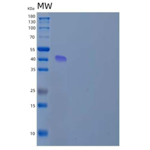 Recombinant Human Argininosuccinate Synthase/ASS1 Protein(N-6His)