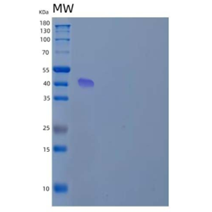 Recombinant Human Argininosuccinate Synthase/ASS1 Protein(N-6His),Recombinant Human Argininosuccinate Synthase/ASS1 Protein(N-6His)