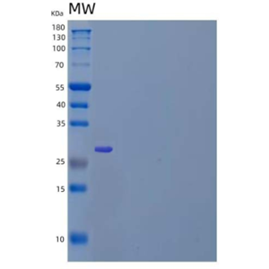 Recombinant Human Protein Disulfide-Isomerase A5/PDIA5 Protein(C-6His)