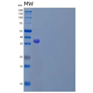 Recombinant Human LAMP1/CD107a Protein(C-6His)