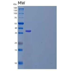 Recombinant Mouse Thrombopoietin/THPO/TPO Protein(N-6His)