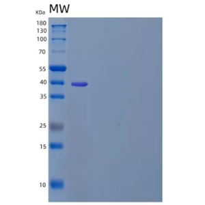 Recombinant Human B- and T-Lymphocyte Attenuator/BTLA/CD272 Protein(C-Fc)