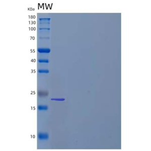 Recombinant Human Autophagy Related 10 Homolog/ATG10 Protein(C-6His, N-T7 tag)