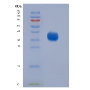 Eukaryotic Cluster Of Differentiation 2 (CD2)