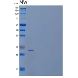 Recombinant Human Tissue Inhibitor of Metalloproteinases 1 Protein