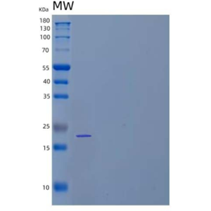 Recombinant Human Tissue Inhibitor of Metalloproteinases 1 Protein,Recombinant Human Tissue Inhibitor of Metalloproteinases 1 Protein