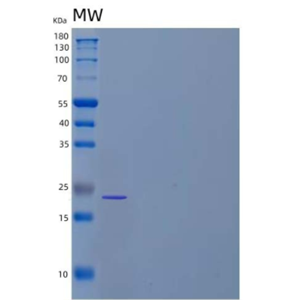 Recombinant Human Leucine-Rich Repeat-Containing Protein 3B/LRRC3B Protein(C-6His)