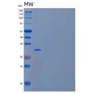 Recombinant Human Ethanolaminephosphotransferase 1/EPT1 Protein(N-GST)