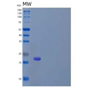 Recombinant Mouse Tissue Inhibitors of Metalloproteinases 1/TIMP1 Protein,Recombinant Mouse Tissue Inhibitors of Metalloproteinases 1/TIMP1 Protein