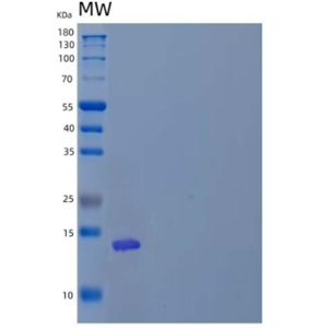 Recombinant Human T cell Immunoreceptor with Ig and ITIM domains Protein/VSTM3