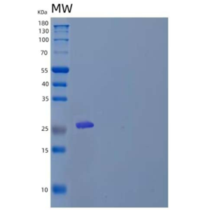 Recombinant Human Bcl-2-Associated Athanogene 1/BAG2 Protein(N-6His)