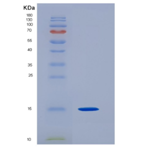 Recombinant Human Eukaryotic Translation Initiation Factor 1B/EIF1B Protein(N-6His)