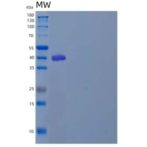 Recombinant Human Leukocyte Surface Antigen CD47/IAP/OA3 Protein(C-Fc)