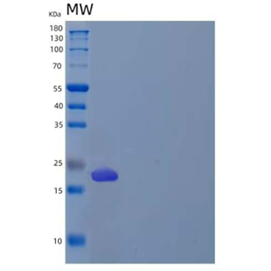 Recombinant Human Bone Marrow Proteoglycan/BMPG Protein(C-6His)