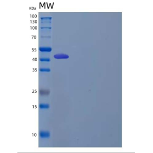 Recombinant Human LIM and Cysteine-Rich Domains Protein 1/LMCD1/Dyxin Protein(N, C-6His)